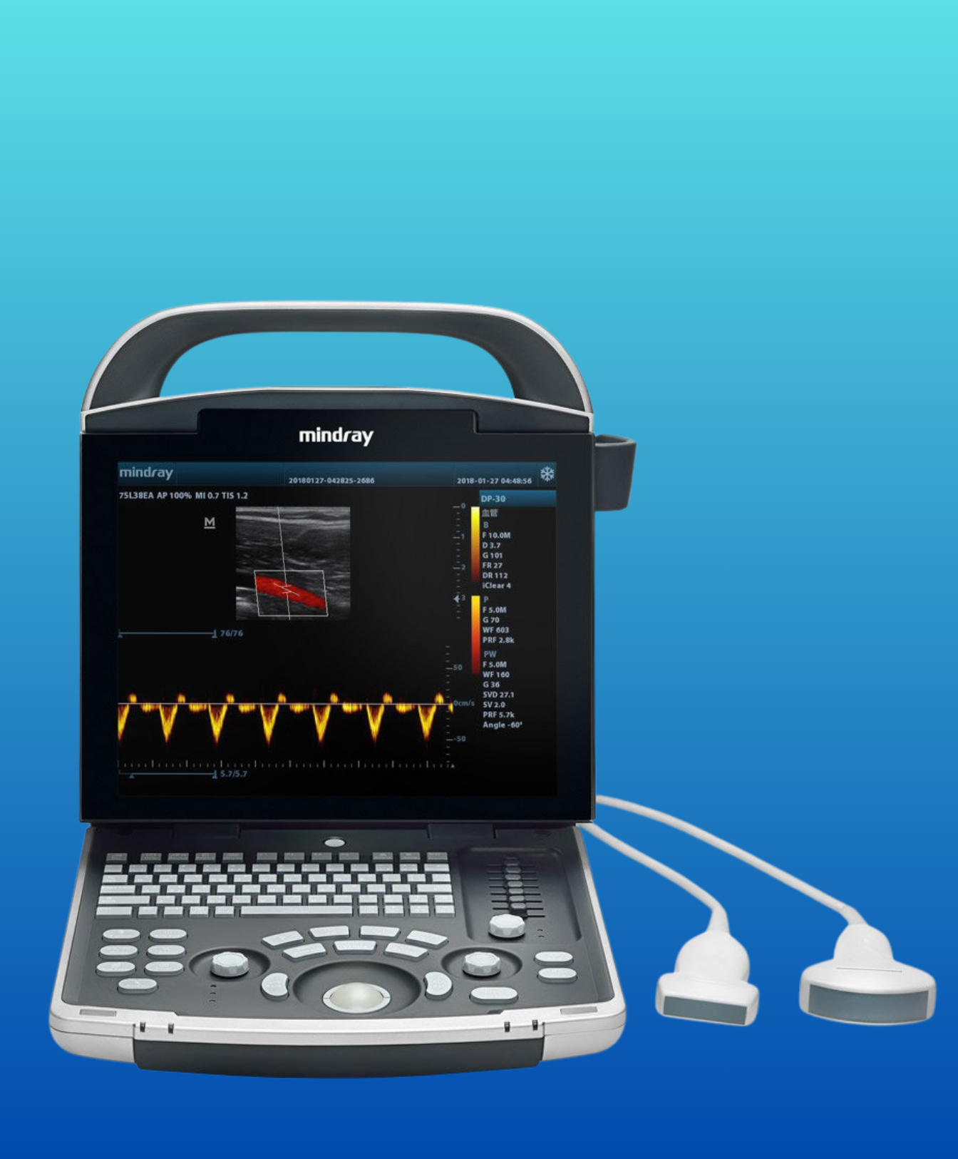 Ultrasound Machine: Mindray DP 25 Power